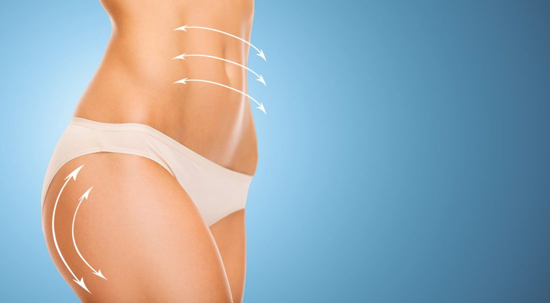 Mesoterapia Catania